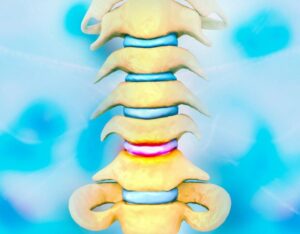 spine image